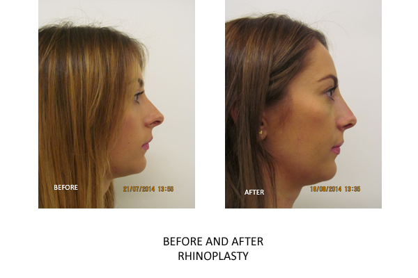 harley street nose clinic reviews